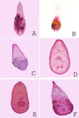  Heterophyes Heterophyes: The Tiny Trematode That Can Give You A 'Fishy' Feeling!